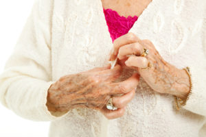 Senior woman's arthritic hands struggling to button her sweater.